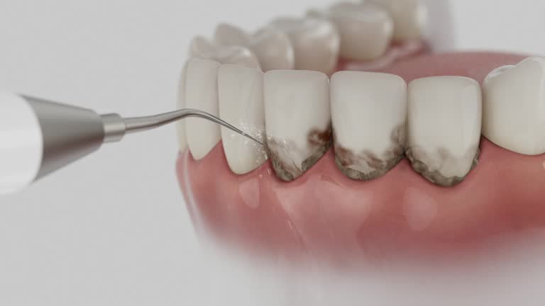 Trusted Emergency Dentist service in Federalsburg, MD - Dentist Open Now